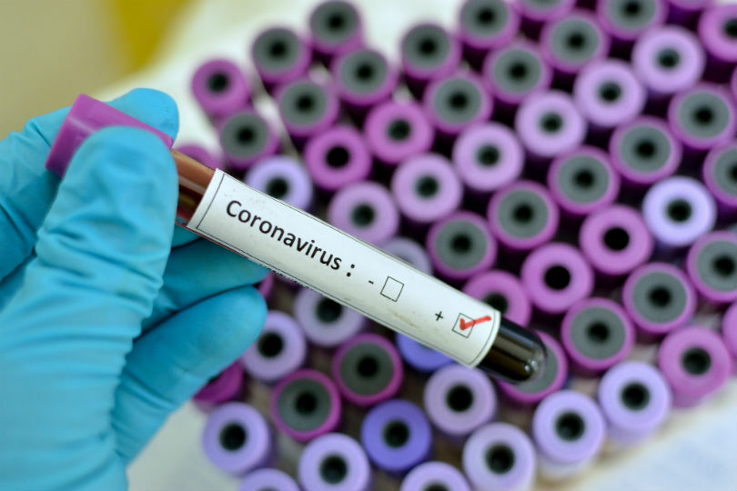 Testing air passengers for coronavirus is 'unrealistic'